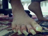 nasty toenails.jpg